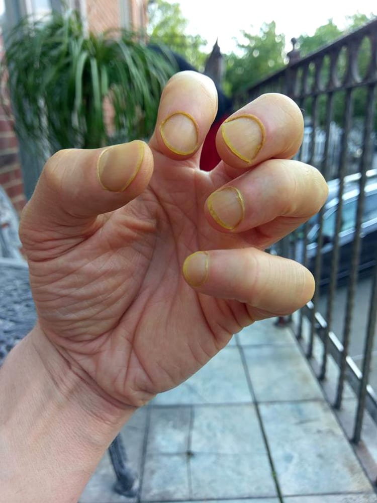curry-stained hands